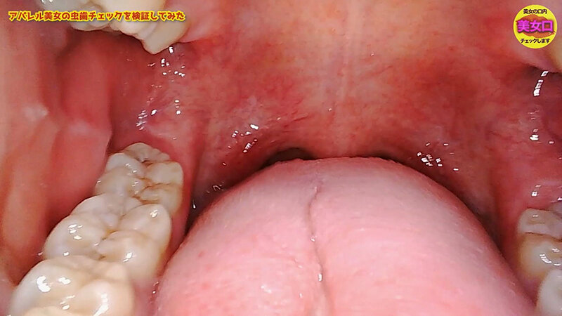 お口の中をじっくり見せてくれませんか？～アパレル店員はるのさん～ 安堂はるの 4